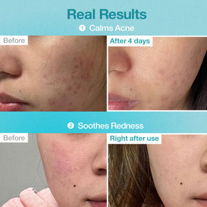 No.1 Pantothenic B5 Hyaluronic Active Clear Mask 5 masks
