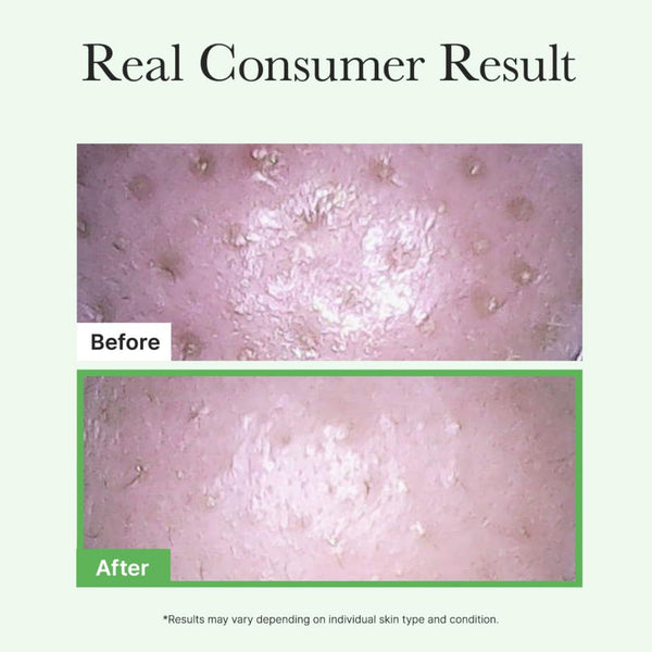 Pore Melt Mochi Cleansing Oil 200ml