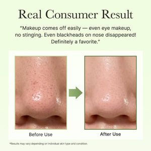 Pore Melt Phyto PDRN Cleansing Balm 90ml