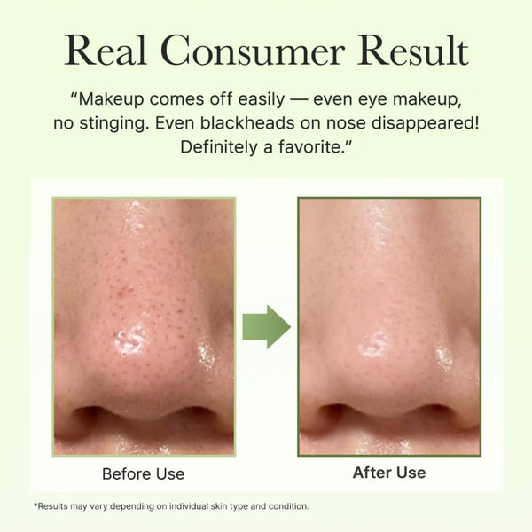 Pore Melt Phyto PDRN Cleansing Balm 90ml