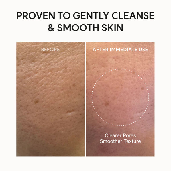 Fresh Rosehip Rice Mochi Cleanser 120g