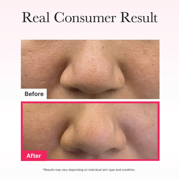 Red Collagen Pore-Tightening Jello Mask 4 masks