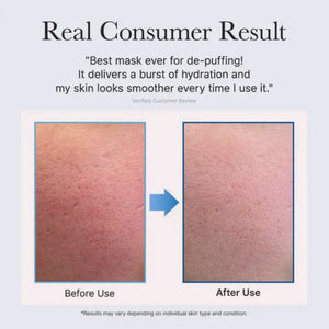 PDRN Blue Collagen Cryo Jello Mask 4 masks
