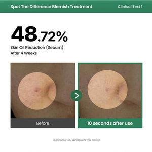 Spot The Difference Blemish Spot Treatment 15ml