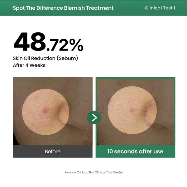 Spot The Difference Blemish Spot Treatment 15ml