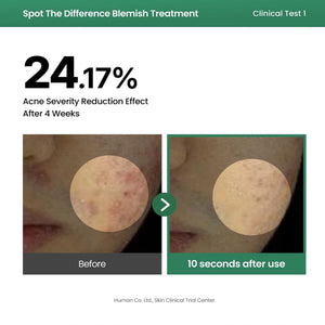 Spot The Difference Blemish Spot Treatment 15ml