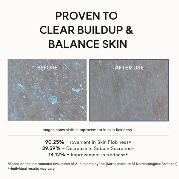 Eraser Shot Glycolic Acid Booster 30ml