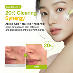 Azelaic Acid 10 Kojic Tea Tree Serum 30ml