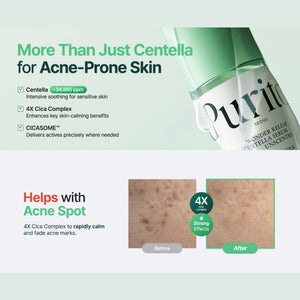 Wonder Releaf Centella Serum Unscented 60ml