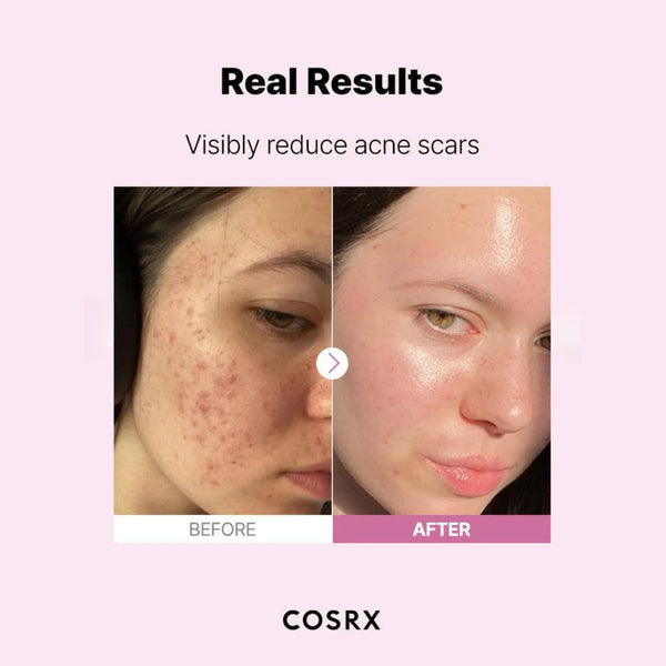 The Niacinamide 15 Serum 20ml