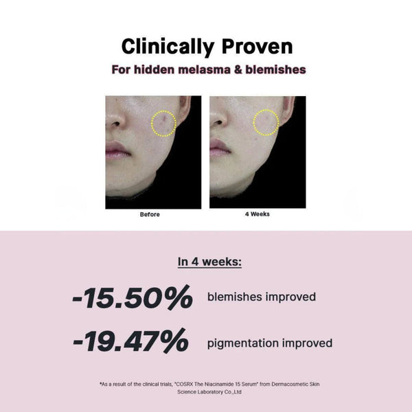The Niacinamide 15 Serum 20ml